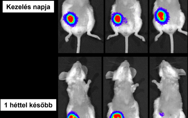 HUN-REN: új lendületet adhat a rák elleni harcnak a magyar kutatók fejlesztése